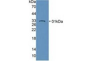 Western blot analysis of recombinant Human PTPN22. (PTPN22 anticorps  (AA 1-233))