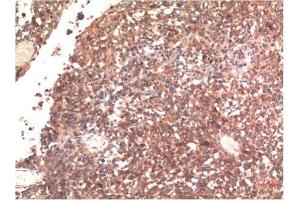 Immunohistochemical analysis of paraffin-embedded Human Brain Tissue using Tau Mouse mAb diluted at 1:200. (tau anticorps)