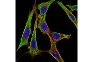 Immunofluorescence analysis of NIH/3T3 cells using FGG mouse mAb (green). (FGG anticorps)