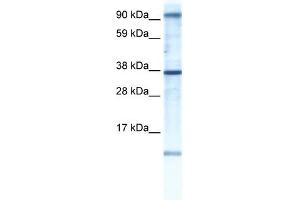 WB Suggested Anti-AKAP7 Antibody Titration:  0. (AKAP7 anticorps  (N-Term))