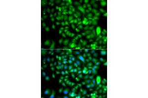 Immunofluorescence analysis of A549 cells using CSRP2BP antibody (ABIN5975516). (CSRP2BP anticorps)