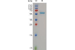 Human , His Tag on SDS-PAGE under reducing condition. (MMP13 Protein (AA 20-471) (His tag))
