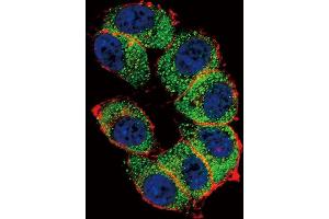 Immunofluorescence (IF) image for anti-Telomerase Reverse Transcriptase (TERT) antibody (ABIN2997736) (TERT anticorps)