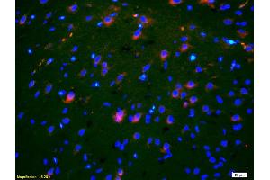 Formalin-fixed and paraffin-embedded rat brain labeled with Anti-OB/CDH11/OB-Cadherin Polyclonal Antibody, Unconjugated (ABIN1387539) 1:200, overnight at 4°C, The secondary antibody was Goat Anti-Rabbit IgG, Cy3 conjugated used at 1:200 dilution for 40 minutes at 37°C. (OB Cadherin anticorps  (AA 310-360))