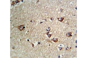 IHC analysis of FFPE human brain tissue stained with CD71 antibody (Transferrin Receptor anticorps  (AA 649-677))