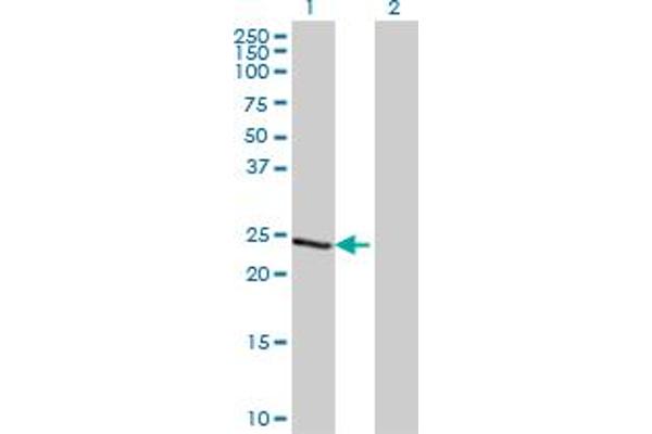 TCEAL1 anticorps  (AA 1-100)