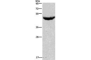 Western blot analysis of Human serum solution, using CXCR2 Polyclonal Antibody at dilution of 1:125 (CXCR2 anticorps)