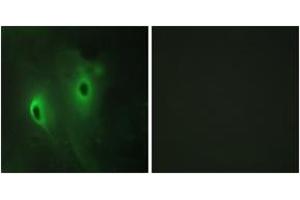 Immunofluorescence analysis of HeLa cells, using DUSP9 Antibody. (DUSP9 anticorps  (AA 151-200))