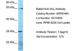 Western Blotting (WB) image for anti-Villin-Like (VILL) (N-Term) antibody (ABIN971993) (VILL anticorps  (N-Term))