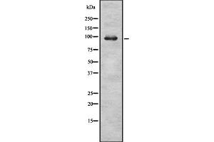 Western blot analysis of RASA2 expression in HEK293 cells ,The lane on the left is treated with the antigen-specific peptide. (RASA2 anticorps  (C-Term))