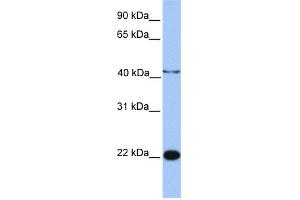WB Suggested Anti-C2orf68 Antibody Titration: 0. (C2orf68 anticorps  (N-Term))