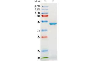 Human IL18 Protein, mFc Tag on SDS-PAGE under reducing condition. (IL-18 Protein (AA 37-197) (mFc Tag))