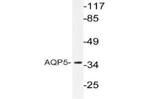 Western blot analysis of AQP5 Antibody in extracts from HUVECcells. (Aquaporin 5 anticorps)