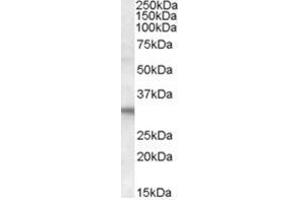 Image no. 1 for anti-Four and A Half LIM Domains 2 (FHL2) (C-Term) antibody (ABIN374413) (FHL2 anticorps  (C-Term))