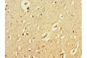 Immunohistochemistry of paraffin-embedded human brain tissue using ABIN7145091 at dilution of 1:100 (ATG5 anticorps  (AA 5-272))