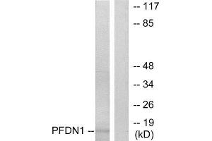 Western Blotting (WB) image for anti-Prefoldin Subunit 1 (PFDN1) (N-Term) antibody (ABIN1849016) (PFDN1 anticorps  (N-Term))