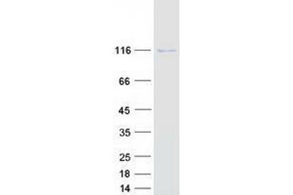 Valyl-tRNA Synthetase 2, Mitochondrial (VARS2) protein (Myc-DYKDDDDK Tag)