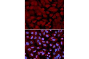 Immunofluorescence analysis of U2OS cells using OGT antibody. (OGT anticorps  (AA 857-1036))