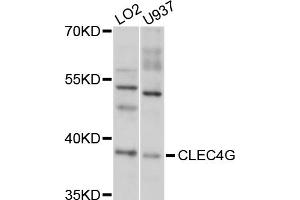 Western blot analysis of extracts of various cell lines, using CLEC4G antibody (ABIN5997464) at 1/1000 dilution. (CLEC4G anticorps)