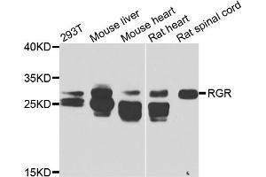 Western blot analysis of extracts of various cell lines, using RGR antibody. (RGR anticorps)