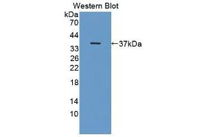 Western blot analysis of the recombinant protein. (OTUB1 anticorps  (AA 1-271))