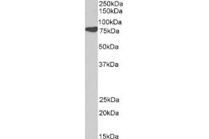 ABIN184659 (0. (Cortactin anticorps  (N-Term))