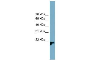 WB Suggested Anti-C1orf93 Antibody Titration: 0. (C1orf93 anticorps  (Middle Region))