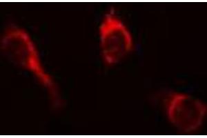 ABIN6267652 staining A431 cells by IF/ICC. (PKC mu anticorps  (pTyr463))