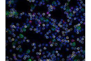 Immunofluorescence (IF) image for anti-CD19 Molecule (CD19) antibody (Alexa Fluor 594) (ABIN2656820) (CD19 anticorps  (Alexa Fluor 594))