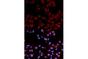 Immunofluorescence analysis of U2OS cells using Phospho-MAPK14-Y182 antibody (ABIN5969911). (MAPK14 anticorps  (pTyr182))
