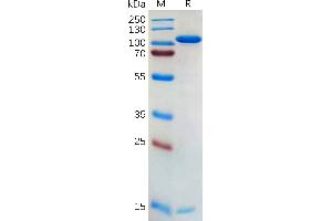 Human P Protein, hFc Tag on SDS-PAGE under reducing condition. (PCSK9 Protein (AA 31-692) (Fc Tag))