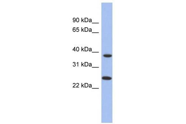 MTRF1L anticorps  (N-Term)