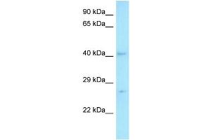 WB Suggested Anti-MED7 Antibody   Titration: 1. (MED7 anticorps  (C-Term))