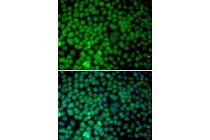 Immunofluorescence analysis of MCF-7 cells using RBX1 antibody (ABIN5970933). (RBX1 anticorps)