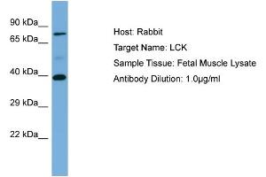 Host: Rabbit Target Name: LCK Sample Type: Fetal Muscle lysates Antibody Dilution: 1. (LCK anticorps  (N-Term))