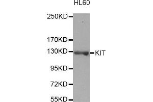 Western blot analysis of extracts of HL-60 cells, using KIT antibody (ABIN3049466). (KIT anticorps)