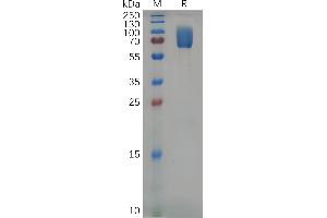 Mouse 2B4 Protein, hFc Tag on SDS-PAGE under reducing condition. (2B4 Protein (AA 20-225) (Fc Tag))