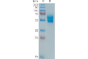 Human APO-1 Protein, hFc Tag on SDS-PAGE under reducing condition. (FAS Protein (AA 26-173) (Fc Tag))