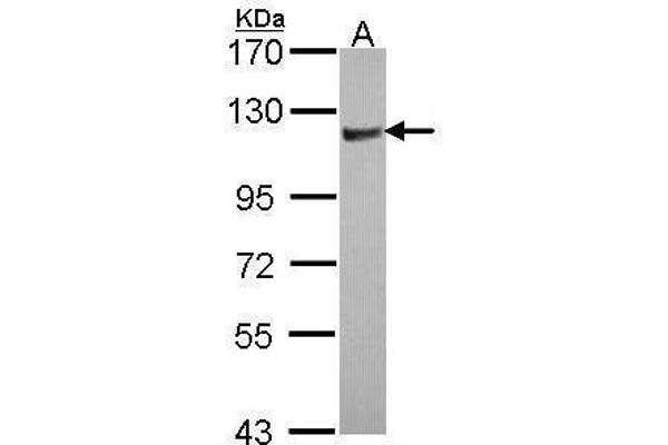 ARHGAP4 anticorps  (N-Term)