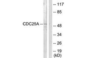 Western Blotting (WB) image for anti-Cell Division Cycle 25 Homolog A (S. Pombe) (CDC25A) (AA 90-139) antibody (ABIN2888800) (CDC25A anticorps  (AA 90-139))