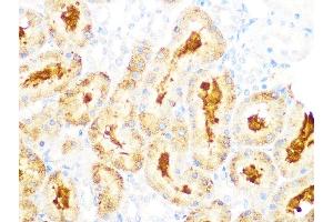 Immunohistochemistry of paraffin-embedded rat kidney using GCLC Rabbit mAb (ABIN1680604, ABIN3018993, ABIN3018994 and ABIN7101696) at dilution of 1:100 (40x lens). (GCLC anticorps)