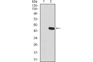 Western Blotting (WB) image for anti-Zinc Finger Protein GLI1 (GLI1) (AA 284-449) antibody (ABIN5866847) (GLI1 anticorps  (AA 284-449))