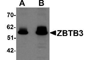 Western Blotting (WB) image for anti-Zinc Finger and BTB Domain Containing 3 (ZBTB3) (C-Term) antibody (ABIN1030811) (ZBTB3 anticorps  (C-Term))