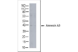 Rabbit anti Annexin A3 on human tonsil lysate (Annexin A3 anticorps)