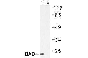 Image no. 1 for anti-BCL2-Associated Agonist of Cell Death (BAD) antibody (ABIN265323) (BAD anticorps)