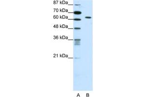 Western Blotting (WB) image for anti-SMAD, Mothers Against DPP Homolog 1 (SMAD1) antibody (ABIN2461769) (SMAD1 anticorps)