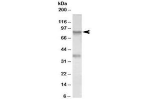 Western blot testing of A549 lysate with VAP-1 antibody at 0. (AOC3 anticorps)