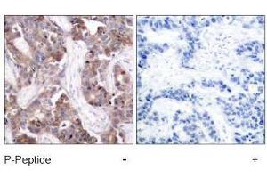 Image no. 1 for anti-Stathmin 1 (STMN1) (pSer24) antibody (ABIN196968) (Stathmin 1 anticorps  (pSer24))