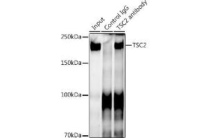 Immunoprecipitation analysis of 300 μg extracts of 293T cells using 3 μg TSC2 antibody (ABIN7271027). (Tuberin anticorps)