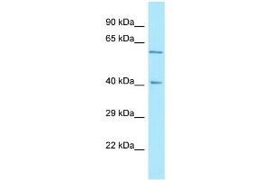 WB Suggested Anti-RTN4RL2 Antibody Titration: 1. (RTN4RL2 anticorps  (C-Term))